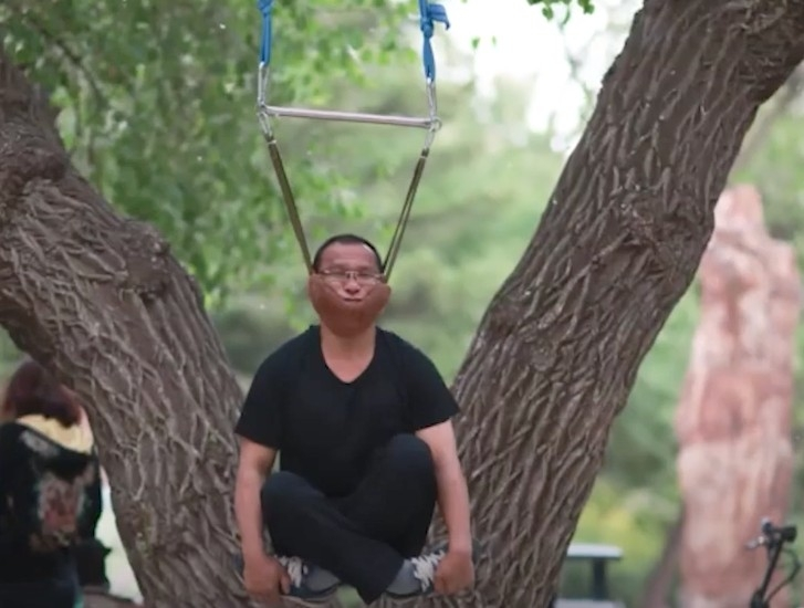 Kho hieu lop hoc “bo ca sau” chua benh dau lung o Trung Quoc-Hinh-2