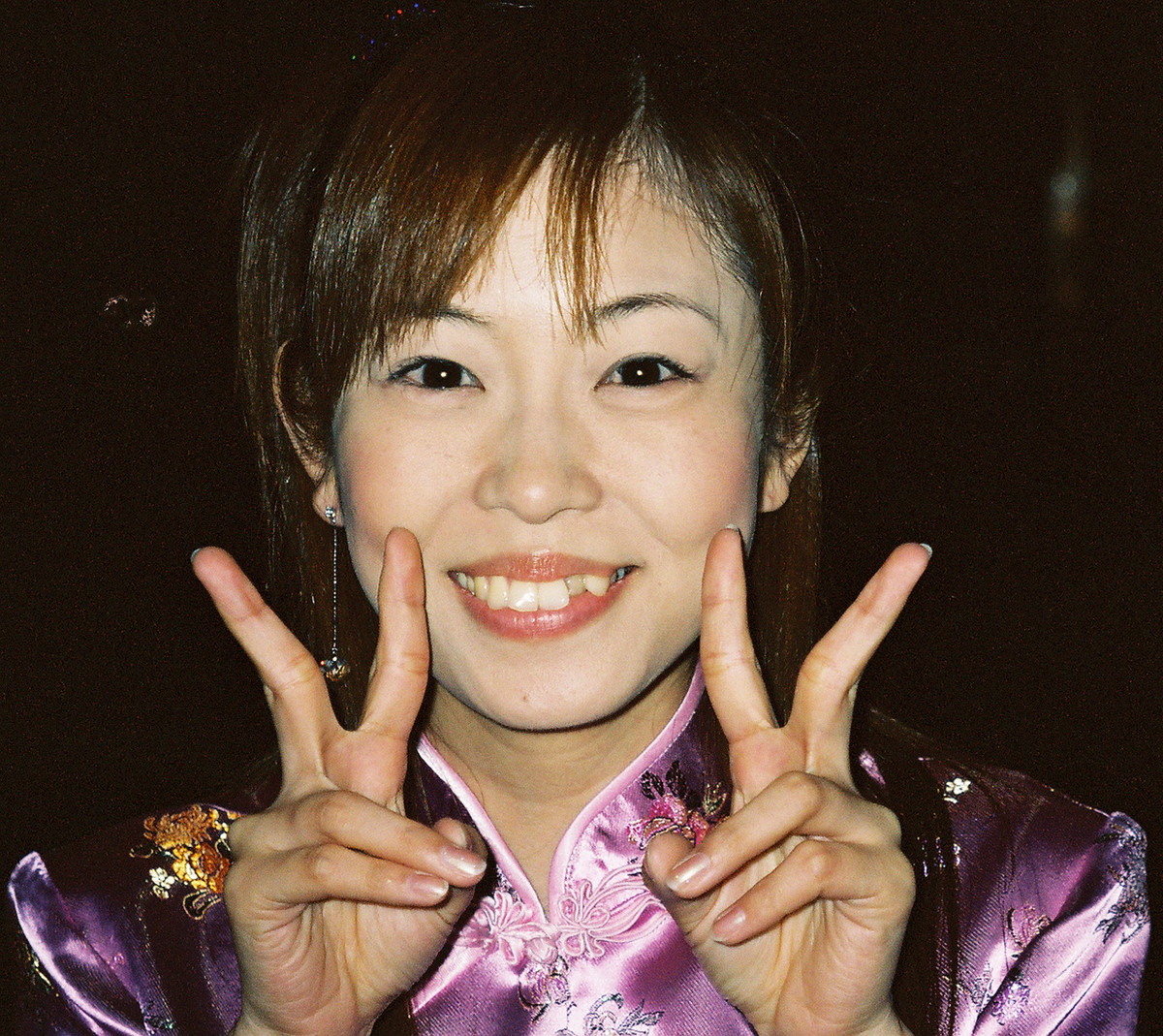 Răng khấp khểnh được coi là nét đẹp của sự trẻ trung và duyên dáng ở Nhật Bản, đến nỗi các cô gái đến nha sĩ với một yêu cầu hơi kỳ lạ là cố tình làm cho răng của họ không đều nhau.