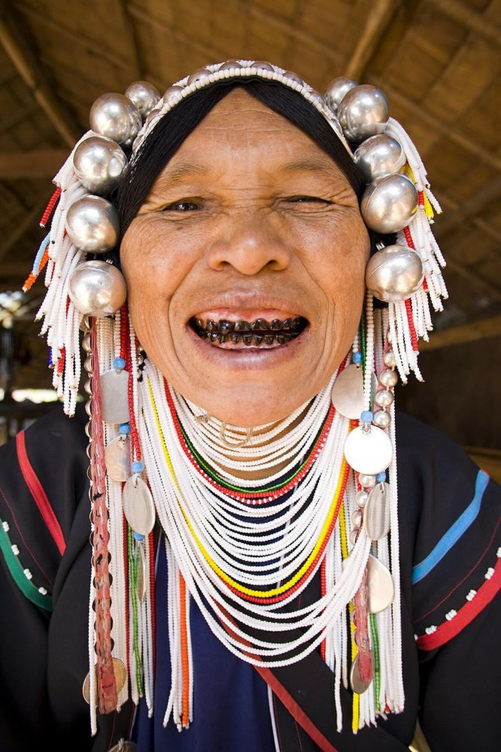 Nhuộm răng đen là một truyền thống lâu đời, chủ yếu xuất hiện ở Đông Nam Á hay một số quốc gia khác ở Châu Á như Ấn Độ hay Nhật Bản. Ở thời xưa, răng đen được coi là biểu tượng của địa vị xã hội, sự trưởng thành, vẻ đẹp và văn minh.