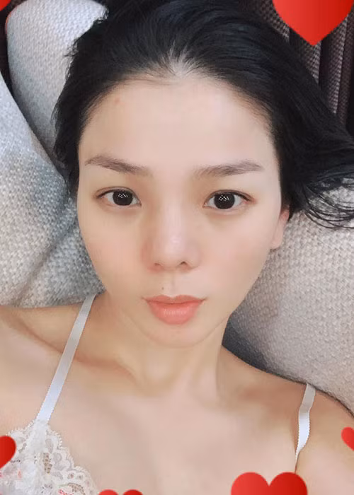 Lệ Quyên tháo sụn mũi cách đây không lâu sau khi chiếc mũi dao kéo của nữ ca sĩ phòng trà gặp biến chứng nặng. Sở hữu chiếc mũi tự nhiên, cô cảm thấy yên tâm với ngoại hình mới.