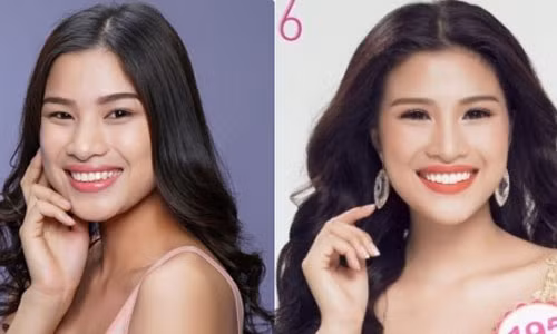 Nguoi dep “dao keo” thi hoa hau quoc te: Den luc bat den xanh?-Hinh-4