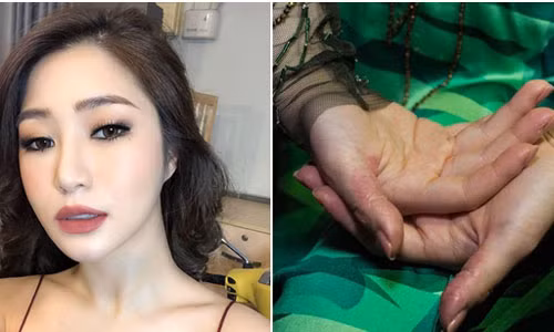 Sao Viet stress huy hoai ban than: Goc khuat dang so sau hao quang