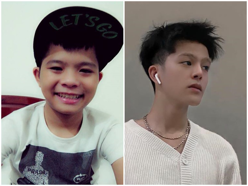 Năm 2013, Quang Anh đăng quang Giọng hát Việt nhí. Từ một cậu nhóc nhỏ nhắn, dễ thương, Quang Anh hiện tại là chàng thanh niên cá tính. Quang Anh thừa nhận dao kéo để gương mặt trở nên góc cạnh, mũi cao, thon gọn. Ảnh: FBNV