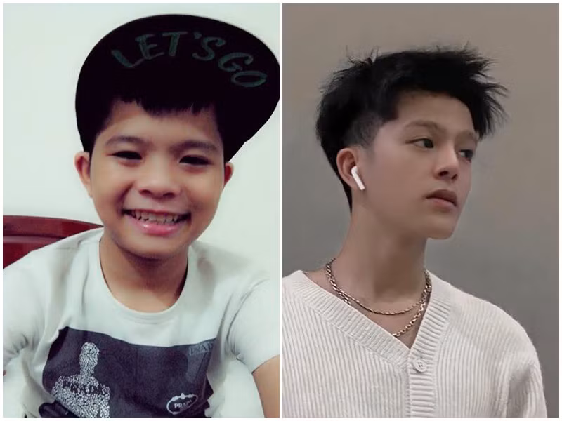 Năm 2013, Quang Anh đăng quang Giọng hát Việt nhí. Từ một cậu nhóc nhỏ nhắn, dễ thương, Quang Anh hiện tại là chàng thanh niên cá tính. Quang Anh thừa nhận dao kéo để gương mặt trở nên góc cạnh, mũi cao, thon gọn. Ảnh: FBNV