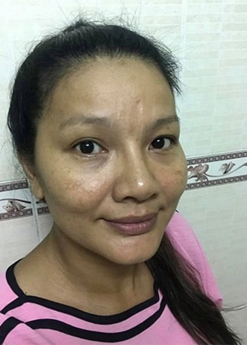 Năm 2019, Kiều Trinh không ngần ngại chia sẻ hình ảnh mặt mộc với làn da đen sạm, tàn nhang. Ảnh: FBNV