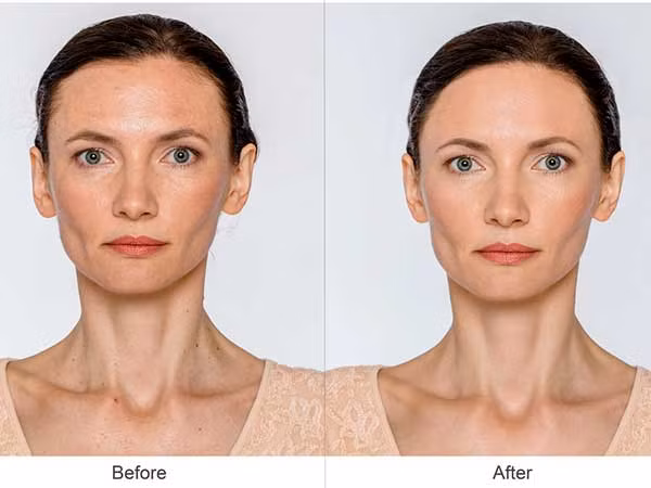 Mặt nạ bột yến mạch: Mặt nạ có thành phần là 1 quả trứng, nửa chén bột yến mạch và 2 muỗng cà phê dầu ô liu hoặc dầu hạnh nhân. 