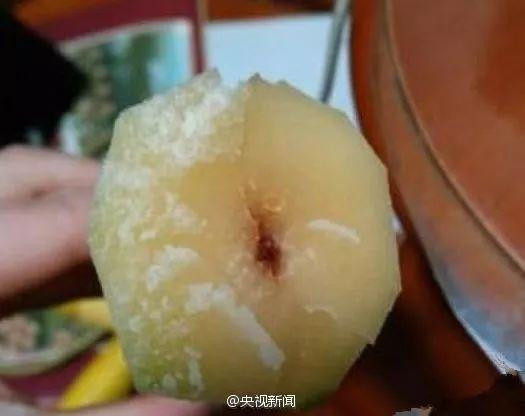 Benh nhan suy da tang sau an mia, vut bo ngay neu co dau hieu nay-Hinh-2