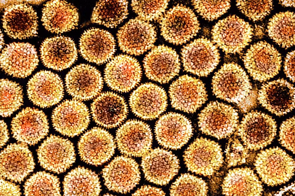 4 câu hỏi lớn về bệnh viêm gan bí ẩn khiến trẻ tử vong 4 cau hoi lon ve benh viem gan bi an khien tre tu vong