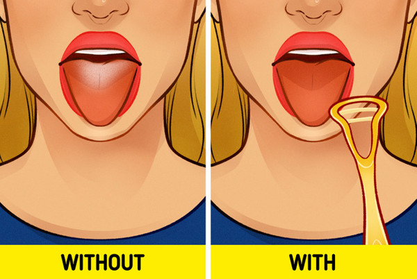 Cạo lưỡi. Chúng ta rất chăm chỉ đánh răng song thường bỏ quên việc cạo lưỡi mỗi ngày. Đây là thói quen đơn giản giúp làm sạch khoang miệng. Cụ thể, nó giúp loại bỏ các mảng bám, vi khuẩn vùng lưỡi. Nhờ vậy, bạn sẽ cải thiện đáng kể tình trạng hôi miệng. (Ảnh: BS, minh họa)