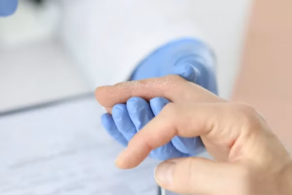 Muon biet phoi khoe hay khong, nhin ban tay biet ngay!