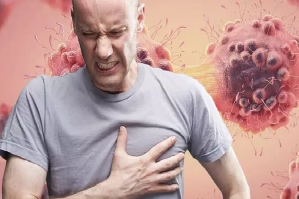 Dau 4 vi tri nay tren co the, coi chung ung thu thuc quan