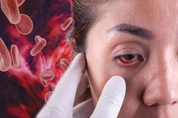 Muốn biết mắc bệnh tiểu đường hay không, nhìn mặt là biết! Muon biet mac benh tieu duong hay khong, nhin mat la biet!