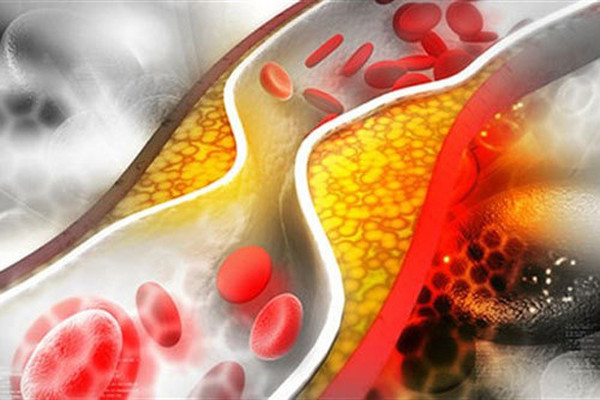 Nghiên cứu chỉ ra ăn chay không khoa học không giúp ngăn ngừa bệnh mỡ máu. Đặc biệt, chuyên gia chỉ rõ ăn các loại rau dưới đây không tốt cho sự ổn định mỡ máu.