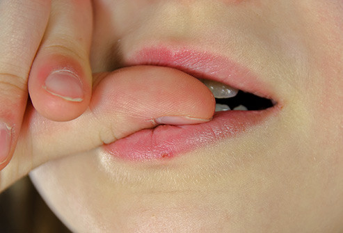  Cắn móng tay Điều này có thể làm hỏng răng cũng như dẫn đến nhiễm trùng vùng da xung quanh móng tay. Bạn cũng có thể bị các bệnh lây nhiễm khi đưa móng tay thường mang vi trùng vào miệng. Nếu căng thẳng là lý do cho thói quen xấu này, bạn có thể thử những cách khác, chẳng hạn như đi dạo, tập thể dục.