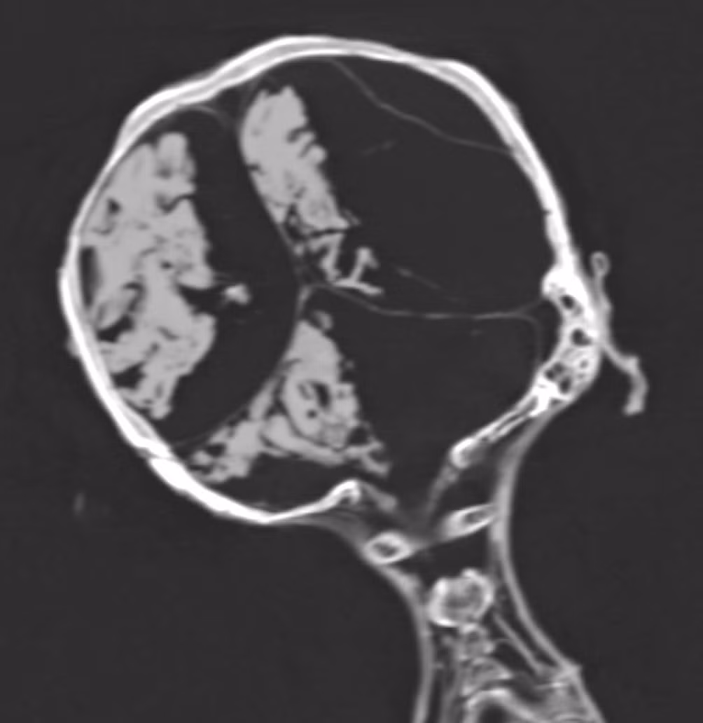 Theo đó, xác ướp được bảo quản theo đúng tư thế lúc qua đời: đầu ngửa ra sau và miệng há to như đang thét lên trong đau đớn.