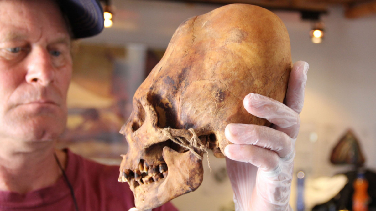 Một điều kỳ lạ nữa là những hộp sọ Paracas chỉ có một lớp xương đỉnh sọ thay vì hai lớp như thường thấy ở người.