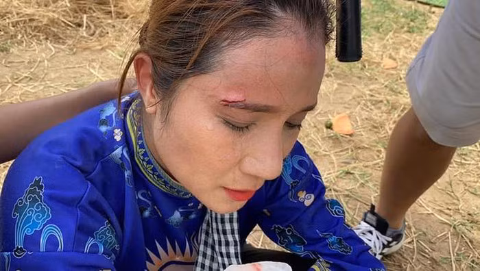 Cát Tường bị đạo cụ rơi vào mặt, phải khâu 3 mũi không thuốc tê Cat Tuong bi dao cu roi vao mat, phai khau 3 mui khong thuoc te