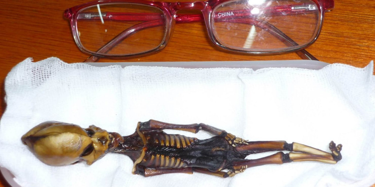 Với vóc dáng nhỏ, xác ướp Atacama khiến dư luận đặc biệt quan tâm bởi có hộp sọ dài, hốc mắt lớn nhưng thiếu xương sườn.