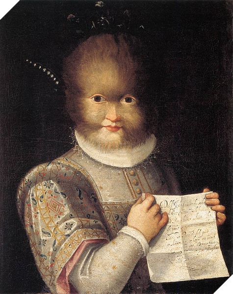 Sau khi quần đảo Canary mà Gonzalez sinh sống bị Tây Ban Nha chiếm đóng, toàn bộ cư dân trở thành nô lệ. Theo đó, Gonzalez cũng trở thành nô lệ và bị đày đọa.