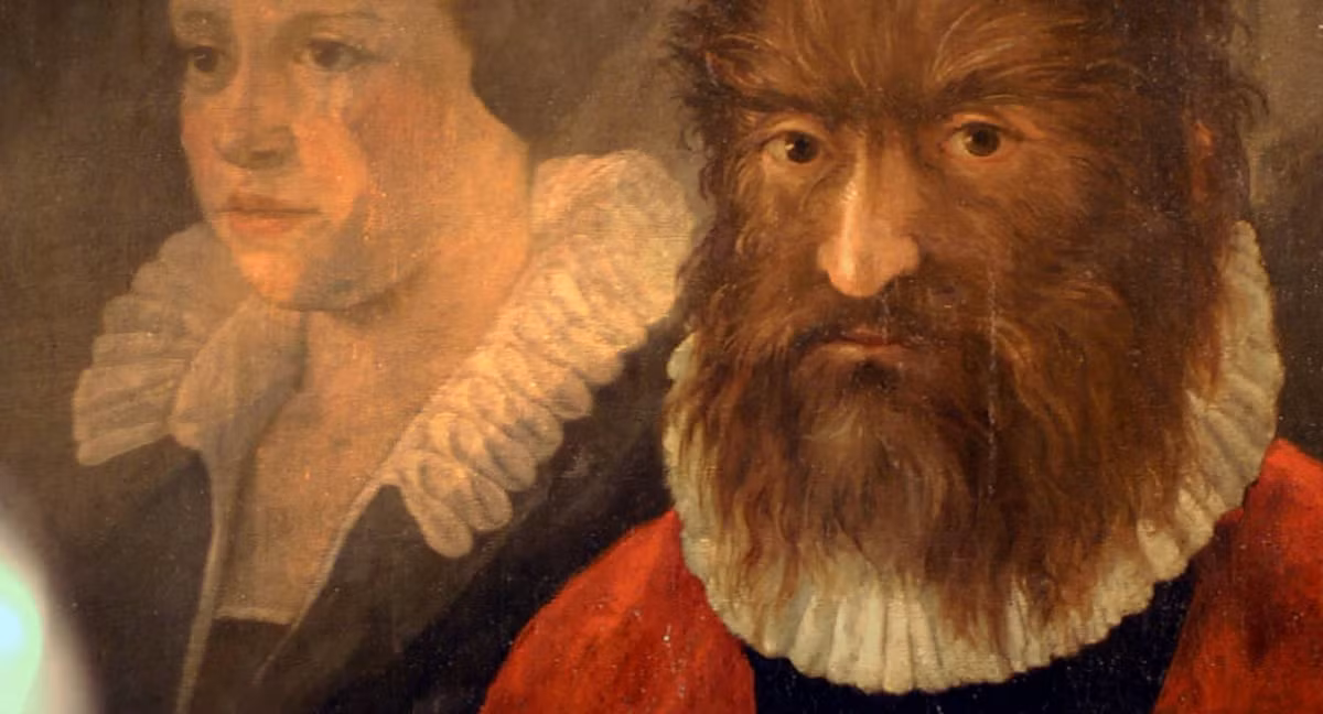 Thức ăn của "người sói" Gonzalez là thịt sống và các loài đồ ăn thừa dành cho chó mèo... Thậm chí, ông còn trở thành thú vui tiêu khiển cho giới quý tộc ở Tây Ban Nha.