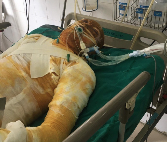 Ke tuoi xang “thieu song” dong nghiep cu bi khoi to ve toi “Giet nguoi”