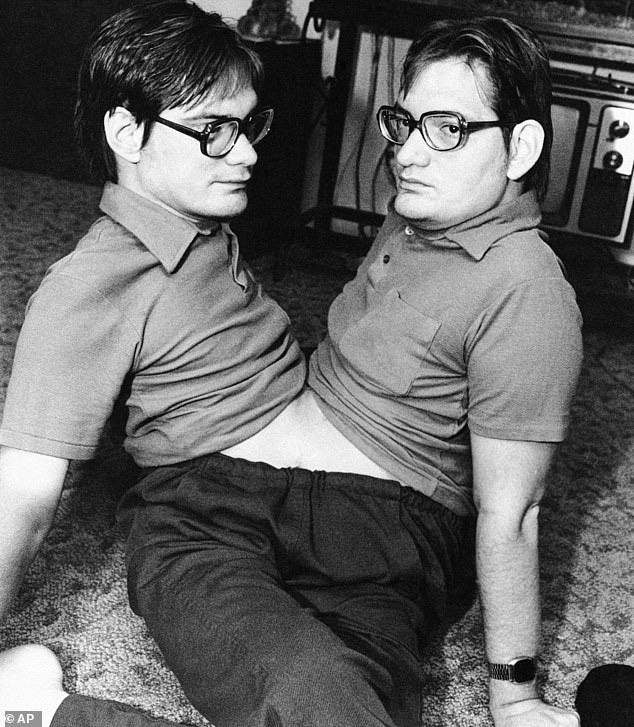 Trong suốt 2 năm sau khi chào đời, Ronnie và Donnie sống trong bệnh viện. Các y bác sĩ cố gắng tìm đủ mọi cách để tách cặp sinh đôi này thành 2 cơ thể độc lập.