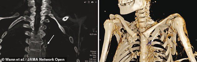 Điều này cho thấy những người Inuit sử dụng nhiều món ăn được chế biến từ các loại cá ở vùng biển lạnh, sâu như: cá thu, cá trích, cá ngừ, cá bơn...