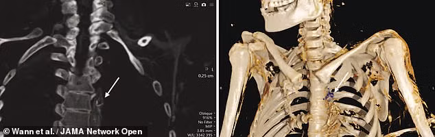 Điều này cho thấy những người Inuit sử dụng nhiều món ăn được chế biến từ các loại cá ở vùng biển lạnh, sâu như: cá thu, cá trích, cá ngừ, cá bơn...