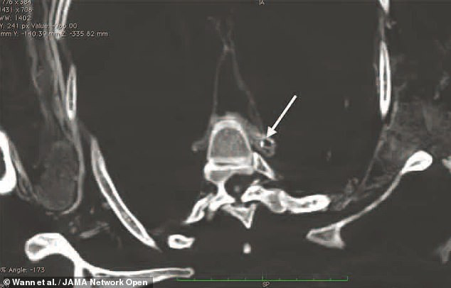 Cụ thể, kết quả nghiên cứu mới cho thấy người Inuit sống cách đây khoảng 500 năm có chế độ ăn giàu axit béo omega-3.
