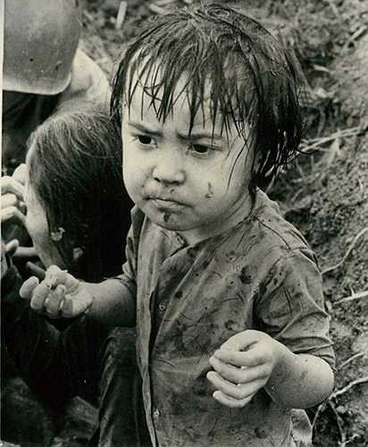 Một bé gái bị thương do tình hình chiến sự khốc liệt. Bức ảnh chụp tại Quảng Nam ngày 21/11/1965.