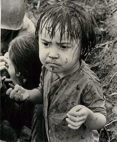 Một bé gái bị thương do tình hình chiến sự khốc liệt. Bức ảnh chụp tại Quảng Nam ngày 21/11/1965.