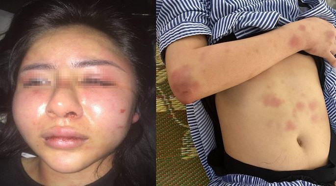 Co gai Yen Bai bi ke yeu don phuong danh da man: Co “xo kham“?