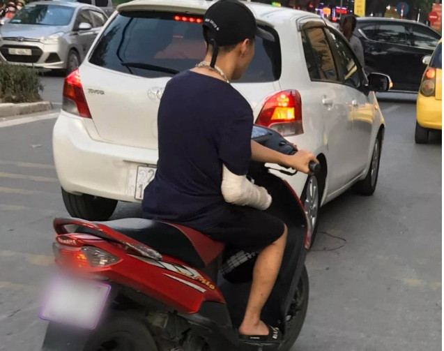 Xôn xao hình ảnh nam thanh niên bị gãy tay phải, vẫn liều mình vặn ga xe máy bằng... tay trái Xon xao hinh anh nam thanh nien bi gay tay phai, van lieu minh van ga xe may bang... tay trai
