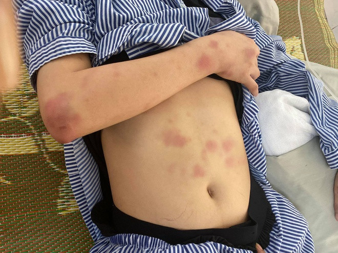 Trieu tap ke hanh hung co gai vi khong yeu suot 2 gio-Hinh-2