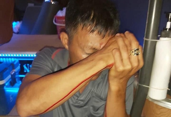 Phu xe o Quy Nhon bi ban thung mat: Ke no sung la ai?