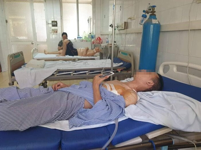 Nam thanh nien truy duoi ten cuop tiem vang ke lai khoanh khac bi vung dao dam chem