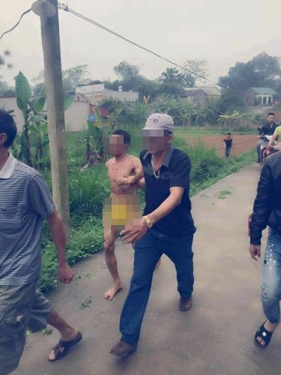 Cao tay hơn, một số người còn liều mạng trần truồng đến dự đám cưới của người yêu cũ với ý đồ gây rối. Không ít gia chủ đã phải nhờ đến sự can thiệp của công an, dân phòng để ngăn chặn những kẻ gây rối này. Không thể lấy lý do tình cảm còn sâu đậm để bao biện được cho những hành vi này, bởi nếu thực sự yêu thương, tôn trọng tình cũ thì vui vẻ chúc phúc, giúp đỡ cô dâu, chú rể cùng gia đình mới là điều nên làm.