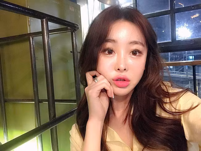 Lý giải nguyên nhân 'baby face' khiến chị em say như điếu đổ, nhiều bạn trẻ cho rằng đó là do khuôn mặt này giúp phái nữ trông trẻ trung, đáng yêu hơn, đó là chưa kể khi kết hợp cùng với chiếc cằm nhọn chữ V vốn được coi là sexy, trông họ sẽ vừa dễ thương và có cả sự gợi cảm. Tuy nhiên, cách làm đẹp nào cũng có thể xảy ra những rủi ro khi một số trường hợp đã bị xảy ra tình trạng mặt phù nề, có phần biến dạng méo mó.