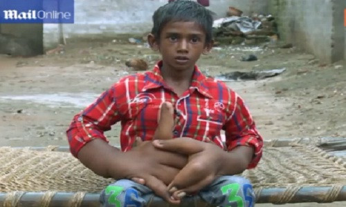 Cau be co doi tay khong lo chua tung thay