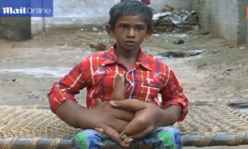 Cau be co doi tay khong lo chua tung thay