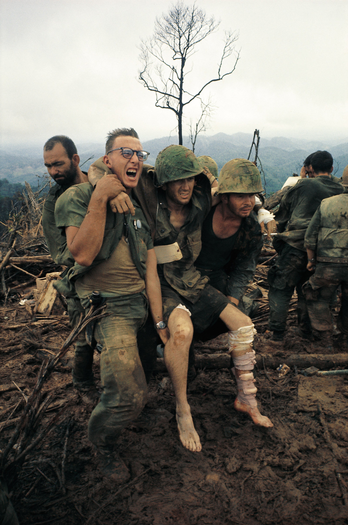 Tướng Kelly tin rằng, nếu phi công Mỹ đang ở một nơi được bảo vệ tốt, yêu cầu máy bay chiến đấu tàng hình F-35 tiếp cận, thì quân đội Mỹ sẽ khó có thể sử dụng thiết bị cứu hộ hiện có (chủ yếu là trực thăng và cường kích A-10), để vào cùng một vùng trời.