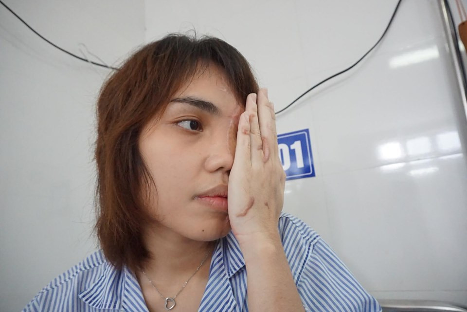 Nhiều lúc Vy vẫn không thể lý giải nổi sao Hải có thể ra tay tàn độc đến vậy.