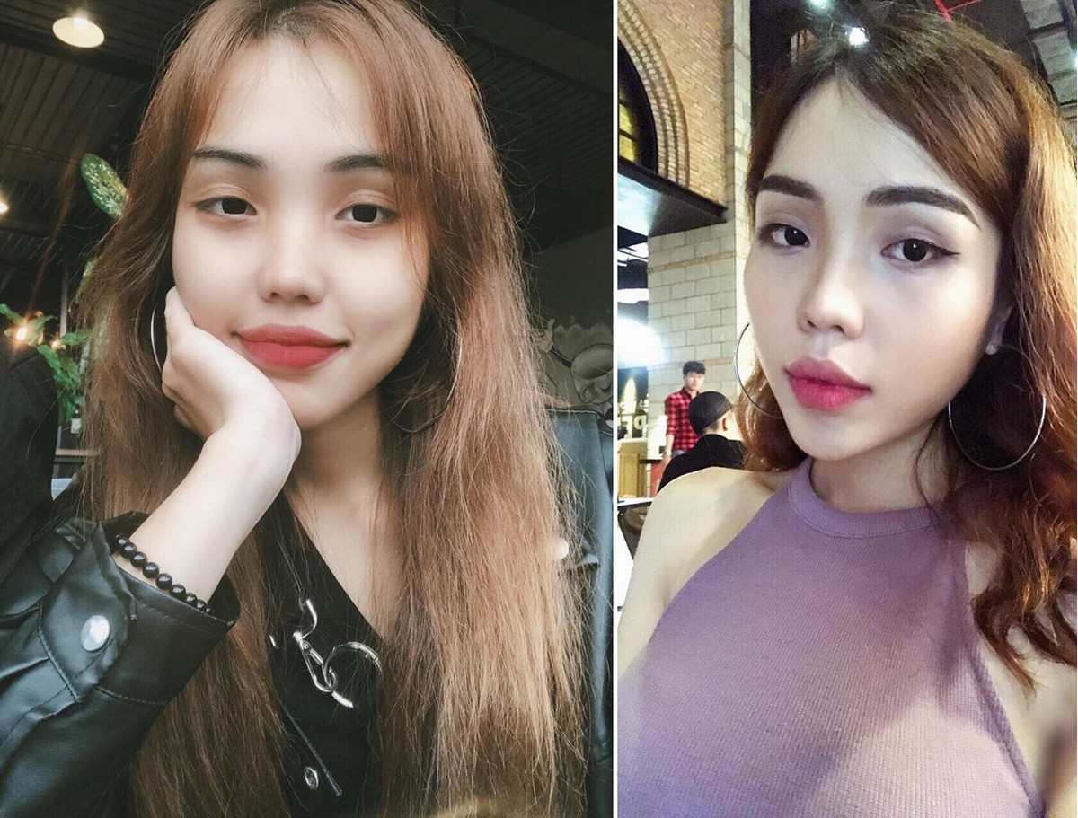 Vy thời điểm chưa bị tạt axit.