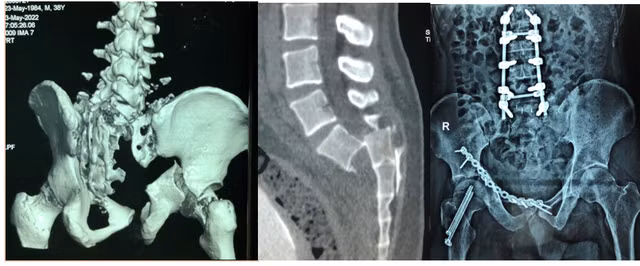 Nguoi dan ong tuong phai ngoi xe lan suot doi duoc hoi sinh