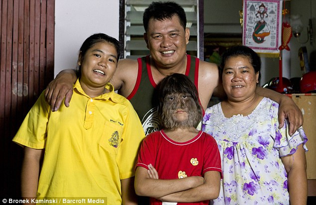 Vào năm 2010, Sasuphan giành kỷ lục Guiness thế giới về bộ "lông sói" kỳ lạ và độc đáo của mình.