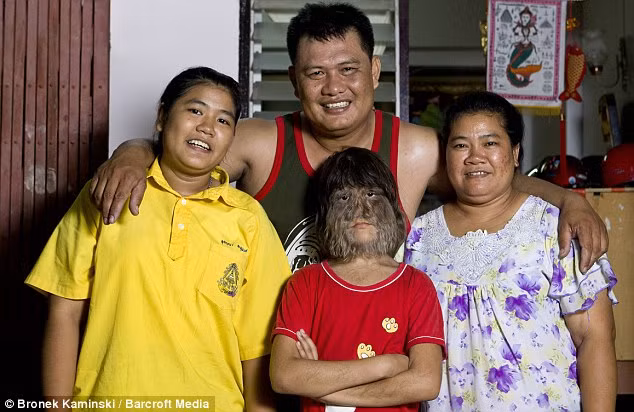 Vào năm 2010, Sasuphan giành kỷ lục Guiness thế giới về bộ "lông sói" kỳ lạ và độc đáo của mình.