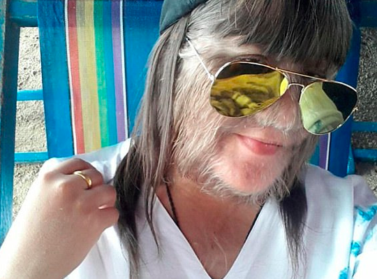 Chính vì vậy, Sasuphan quyết định cạo lông trên mặt thường xuyên để thuận tiện hơn trong đời sống sinh hoạt hàng ngày cũng như cho mọi người thấy diện mạo thật sự của cô.