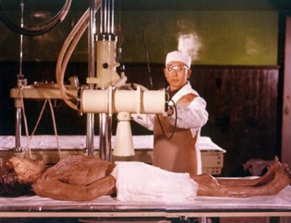 Theo các chuyên gia, bệnh tim nặng chính là nguyên nhân khiến Tân Truy phu nhân bỏ mạng. Nguyên do khiến Tân Truy phu nhân mắc bệnh tim được cho là xuất phát từ cuộc sống xa hoa của bà.