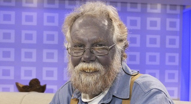 Vợ chồng Martin có với nhau 7 người con. Trong số này, 4 người con của họ có da màu xanh như bầu trời. Tất cả con của gia đình nhà Fugate đều lớn lên khỏe mạnh như người bình thường. Về sau, con cháu gia đình này lần lượt kết hôn và sinh ra những đứa trẻ cũng có da màu xanh.