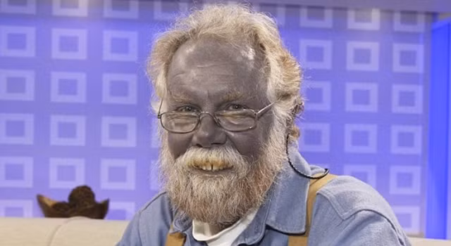 Vợ chồng Martin có với nhau 7 người con. Trong số này, 4 người con của họ có da màu xanh như bầu trời. Tất cả con của gia đình nhà Fugate đều lớn lên khỏe mạnh như người bình thường. Về sau, con cháu gia đình này lần lượt kết hôn và sinh ra những đứa trẻ cũng có da màu xanh.